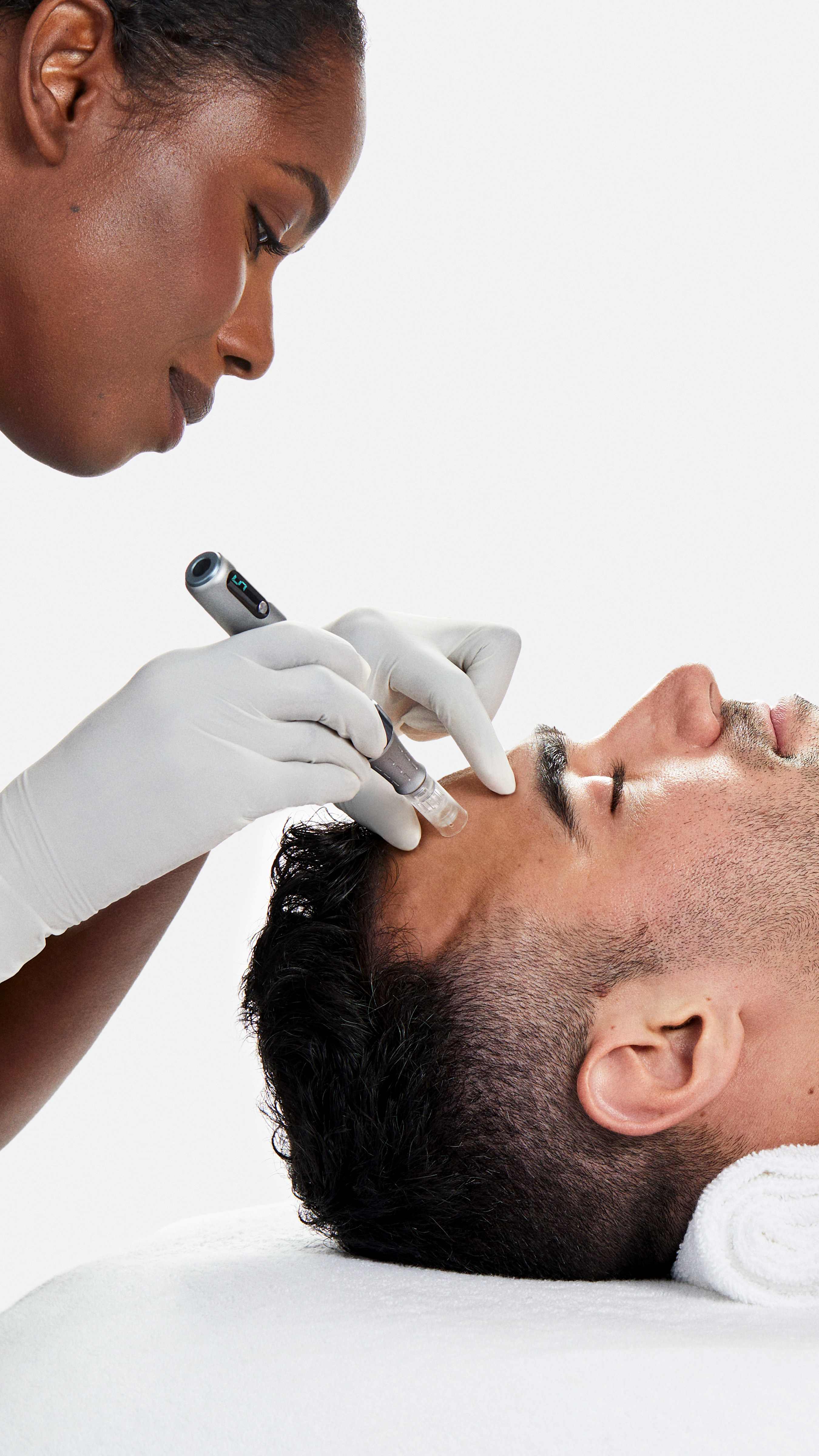 pro skin needling