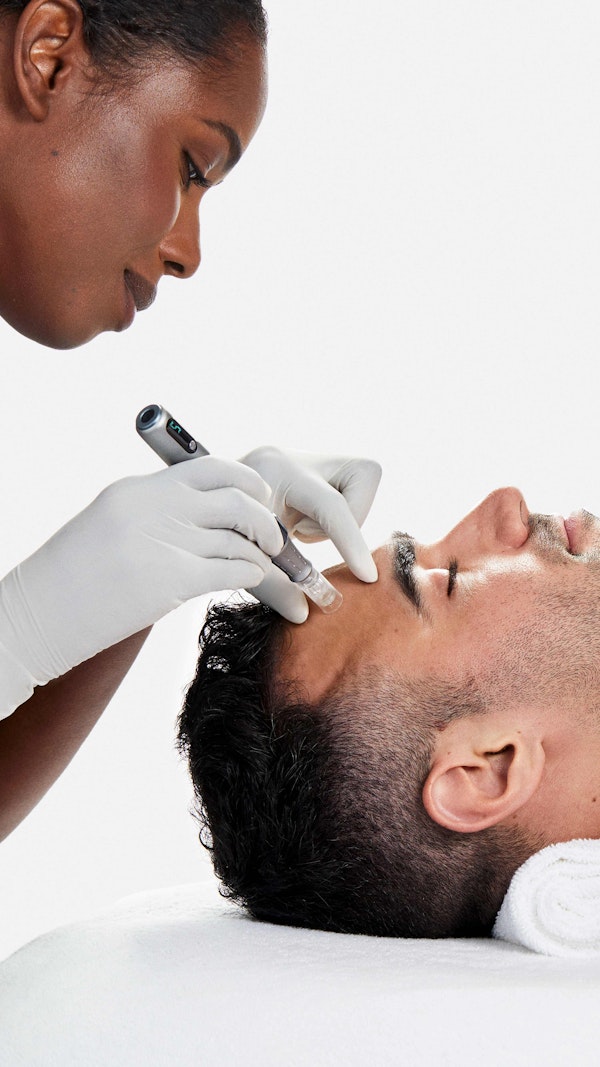pro skin needling