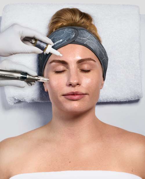 Exo Booster micro-needling
